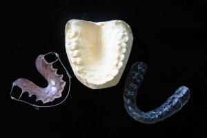 Hoe 3D-printen het medische veld revolutioneert: 4 sleuteltoepassingen & toekomstrends