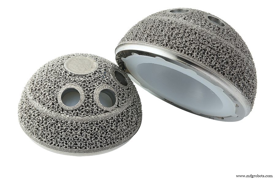 Metalen 3D-printen: 5 high-tech toepassingen die de industrie transformeren
