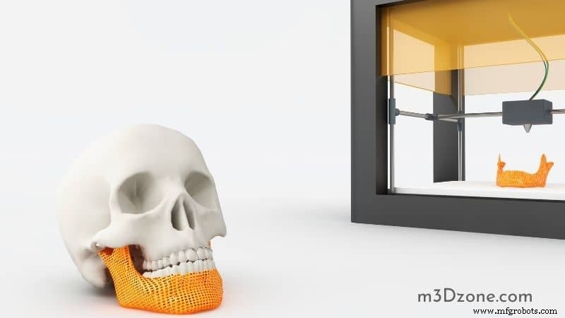 3D-printers en lasersnijders vergelijken: additieve vs. subtractieve productie